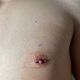 Nipple