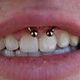 Smiley