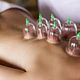 Hijama wet cupping cups 7