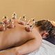 Cupping