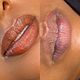 👄 Lip Neutralisatie