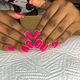 Gel overlay
