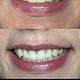 Perfect smile