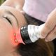 Radiofrecuencia facial