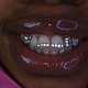Brace Design