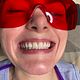 Zoom Teeth Whitening
