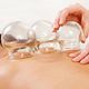 Cupping