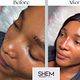 NOSE FILLER
