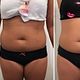 Love handles/ waistline