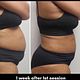 Tummy slimming