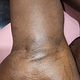 Underarm