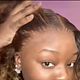 Frontal/closure Reinstall