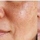 Facial y corporal