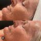 Buccal massage