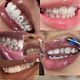 Customize tooth gem