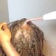 Scalp Treatment