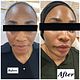 Glass skin facials (N120,000)