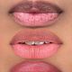 Lower lip (Per Session)