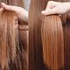 Haar Botox behandeling