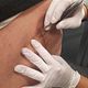 Wondzorg compleet incl. negatieve druktherapie