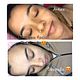 Limpieza facial profunda