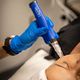 SkinPen (2 zones)