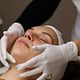 Extractions & Peeling (1 zone)