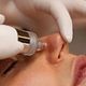 Hydra-Facial \ Hydrapeel