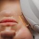 IPL Light Therapy (redness / age- sunspots)