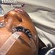 Lash Refils