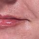 0.5ml Lips