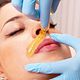 Bovenlip sugaring
