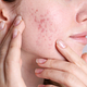 Asesoría en Nutrición Hormonal