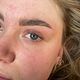 Brow lamination excl verven