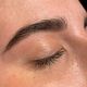 Brow treatment