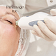 Thermage FLX