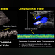 VENOUS OR ARTERIAL DUPLEX SCAN (one leg)