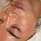 Glow facial