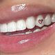 Tooth Gems