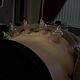 60min sports massage & dry cupping