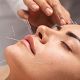 Cosmetic Facial Acupuncture
