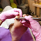 Medische pedicure kort