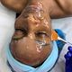 Deep cleansing facial