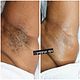 Underarm Waxing