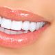 Teeth Whitening 2 x 25 min.