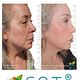 SQT - Anti-aging