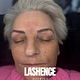 BROW behandeling