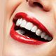 Diamond smile