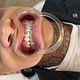 Broken Brackets
