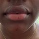 Boven lip